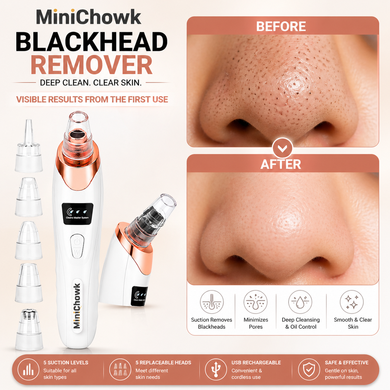 Blackhead Remover Machine