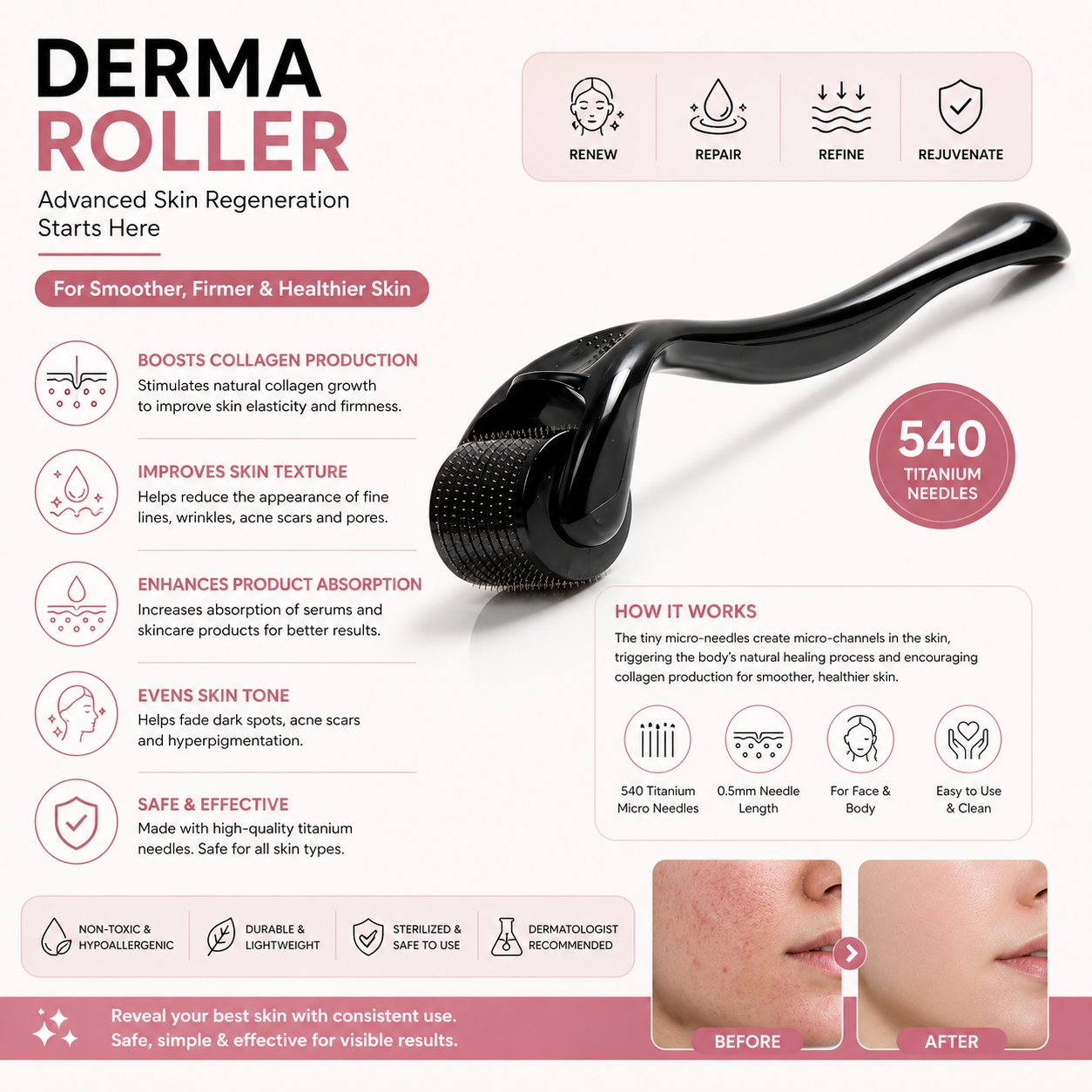 Derma Roller